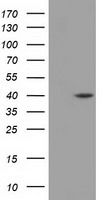 DHPS Antibody - HEK293T cells were transfected with the pCMV6-ENTRY control (Left lane) or pCMV6-ENTRY DHPS (Right lane) cDNA for 48 hrs and lysed. Equivalent amounts of cell lysates (5 ug per lane) were separated by SDS-PAGE and immunoblotted with anti-DHPS.
