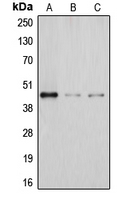 DHPS Antibody - Western blot analysis of DHPS expression in Jurkat (A); JAR (B); HeLa (C) whole cell lysates.