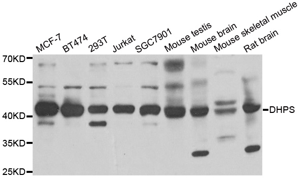 DHPS Antibody - Western blot analysis of extracts of various cell lines.