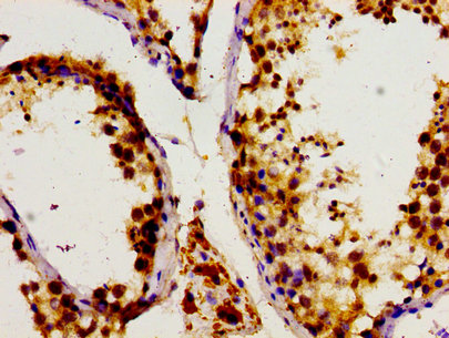 DHPS Antibody - Immunohistochemistry image of paraffin-embedded human testis tissue at a dilution of 1:100