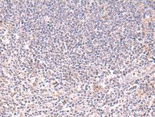 DHPS Antibody - Immunohistochemistry of paraffin-embedded Human tonsil tissue  using DHPS Polyclonal Antibody at dilution of 1:75(×200)