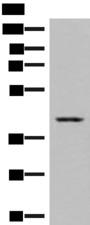 DHPS Antibody - Western blot analysis of Human placenta tissue lysates  using DHPS Polyclonal Antibody at dilution of 1:550