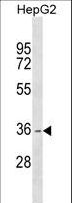 DHRS1 Antibody - DHRS1 Antibody western blot of HepG2 cell line lysates (35 ug/lane). The DHRS1 antibody detected the DHRS1 protein (arrow).