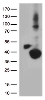 DHRS1 Antibody - HEK293T cells were transfected with the pCMV6-ENTRY control. (Left lane) or pCMV6-ENTRY DHRS1. (Right lane) cDNA for 48 hrs and lysed. Equivalent amounts of cell lysates. (5 ug per lane) were separated by SDS-PAGE and immunoblotted with anti-DHRS1. (1:500)
