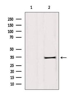 DHRS1 Antibody - Western blot analysis of extracts of rat brain tissue using DHRS1 antibody. Lane 1 was treated with the blocking peptide.