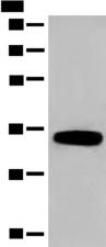 DHRS1 Antibody - Western blot analysis of Human fetal liver tissue lysate  using DHRS1 Polyclonal Antibody at dilution of 1:400
