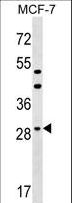 DHRS11 / MGC4172 Antibody - DHRS11 Antibody western blot of MCF-7 cell line lysates (35 ug/lane). The DHRS11 antibody detected the DHRS11 protein (arrow).