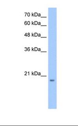 DHRS11 / MGC4172 Antibody - HepG2 cell lysate. Antibody concentration: 0.5 ug/ml. Gel concentration: 12%.  This image was taken for the unconjugated form of this product. Other forms have not been tested.