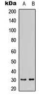 DHRS11 / MGC4172 Antibody - Western blot analysis of DHRS11 expression in MCF7 (A); mouse kidney (B) whole cell lysates.