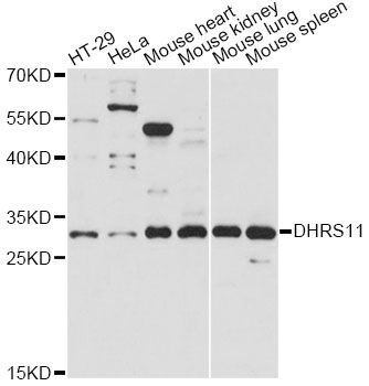 DHRS11 / MGC4172 Antibody - Western blot analysis of extracts of various cell lines, using DHRS11 antibody at 1:1000 dilution. The secondary antibody used was an HRP Goat Anti-Rabbit IgG (H+L) at 1:10000 dilution. Lysates were loaded 25ug per lane and 3% nonfat dry milk in TBST was used for blocking. An ECL Kit was used for detection and the exposure time was 30s.