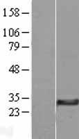 DHRS11 / MGC4172 Protein - Western validation with an anti-DDK antibody * L: Control HEK293 lysate R: Over-expression lysate