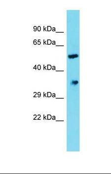 DHRS12 Antibody - Western blot of Human fetal liver lysate. DHRS12 antibody dilution 1.0 ug/ml.  This image was taken for the unconjugated form of this product. Other forms have not been tested.