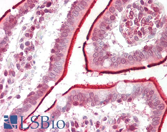DHRS12 Antibody - Human Small Intestine: Formalin-Fixed, Paraffin-Embedded (FFPE).  This image was taken for the unconjugated form of this product. Other forms have not been tested.