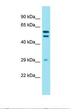 DHRS12 Antibody - Western blot of Human A549. DHRS12 antibody dilution 1.0 ug/ml.  This image was taken for the unconjugated form of this product. Other forms have not been tested.