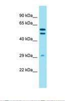 DHRS12 Antibody - Western blot of Human A549. DHRS12 antibody dilution 1.0 ug/ml.  This image was taken for the unconjugated form of this product. Other forms have not been tested.