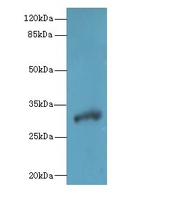 DHRS12 Antibody - Western blot. All lanes: DHRS12 antibody at 1.3 ug/ml+ Human placenta tissue Goat polyclonal to rabbit at 1:10000 dilution. Predicted band size: 31 kDa. Observed band size: 31 kDa.