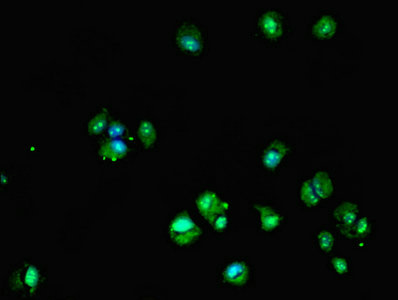 DHRS12 Antibody - Immunofluorescent analysis of MCF-7 cells using DHRS12 Antibody at dilution of 1:100 and Alexa Fluor 488-congugated AffiniPure Goat Anti-Rabbit IgG(H+L)