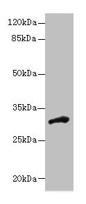 DHRS12 Antibody - Western blot All lanes: DHRS12 antibody at 1.3µg/ml + Human placenta tissue Secondary Goat polyclonal to rabbit IgG at 1/10000 dilution Predicted band size: 36, 28, 31 kDa Observed band size: 31 kDa