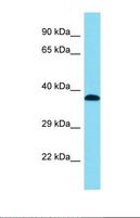 DHRS13 Antibody - Western blot of Human MCF7. DHRS13 antibody dilution 1.0 ug/ml.  This image was taken for the unconjugated form of this product. Other forms have not been tested.