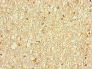 DHRS13 Antibody - Immunohistochemistry of paraffin-embedded human brain tissue using DHRS13 Antibody at dilution of 1:100