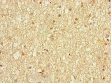 DHRS13 Antibody - Immunohistochemistry of paraffin-embedded human brain tissue using DHRS13 Antibody at dilution of 1:100