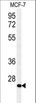 DHRS2 / HEP27 Antibody - DHRS2 Antibody western blot of MCF-7 cell line lysates (35 ug/lane). The DHRS2 antibody detected the DHRS2 protein (arrow).