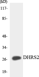 DHRS2 / HEP27 Antibody - Western blot analysis of the lysates from HeLa cells using DHRS2 antibody.