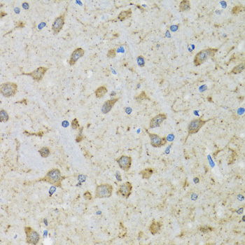 DHRS2 / HEP27 Antibody - Immunohistochemistry of paraffin-embedded mouse brain tissue.