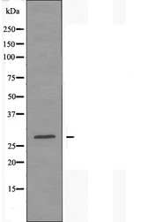 DHRS2 / HEP27 Antibody - Western blot analysis of extracts of COLO cells using DHRS2 antibody.