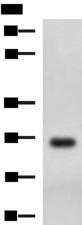 DHRS2 / HEP27 Antibody - Western blot analysis of MCF7 cell lysate  using DHRS2 Polyclonal Antibody at dilution of 1:750