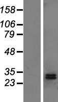 DHRS2 / HEP27 Protein - Western validation with an anti-DDK antibody * L: Control HEK293 lysate R: Over-expression lysate