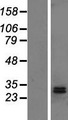 DHRS2 / HEP27 Protein - Western validation with an anti-DDK antibody * L: Control HEK293 lysate R: Over-expression lysate