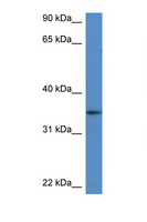 DHRS3 / SDR1 Antibody - DHRS3 antibody Western blot of Mouse Spleen lysate. Antibody concentration 1 ug/ml.  This image was taken for the unconjugated form of this product. Other forms have not been tested.