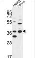 DHRS3 / SDR1 Antibody - DHRS3 Antibody western blot of HepG2 cell line and mouse liver tissue lysates (35 ug/lane). The DHRS3 antibody detected the DHRS3 protein (arrow).