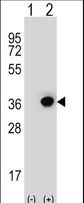 DHRS3 / SDR1 Antibody - Western blot of DHRS3 (arrow) using rabbit polyclonal DHRS3 Antibody. 293 cell lysates (2 ug/lane) either nontransfected (Lane 1) or transiently transfected (Lane 2) with the DHRS3 gene.
