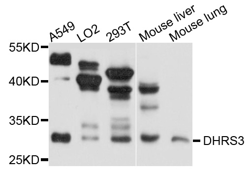 DHRS3 / SDR1 Antibody - Western blot analysis of extracts of A375 cells.