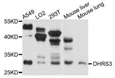 DHRS3 / SDR1 Antibody - Western blot analysis of extracts of A375 cells.