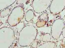 DHRS3 / SDR1 Antibody - Immunohistochemistry of paraffin-embedded human thyroid tissue using antibody at dilution of 1:100.