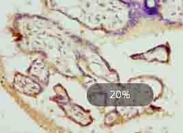 DHRS3 / SDR1 Antibody - Immunohistochemistry of paraffin-embedded human placenta tissue using antibody at dilution of 1:100.