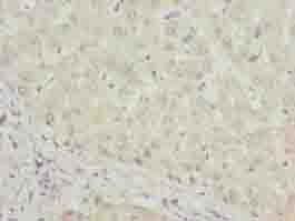 DHRS3 / SDR1 Antibody - Immunohistochemistry of paraffin-embedded human liver tissue using antibody at dilution of 1:100.