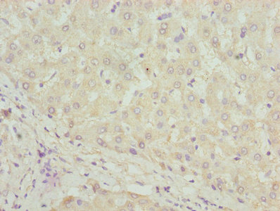 DHRS3 / SDR1 Antibody - Immunohistochemistry of paraffin-embedded human liver tissue using DHRS3 Antibody at dilution of 1:100