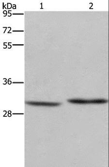 DHRS3 / SDR1 Antibody - Western blot analysis of Mouse liver tissue and A375 cell, using DHRS3 Polyclonal Antibody at dilution of 1:550.
