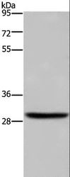 DHRS3 / SDR1 Antibody - Western blot analysis of A375 cell, using DHRS3 Polyclonal Antibody at dilution of 1:600.