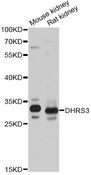 DHRS3 / SDR1 Antibody - Western blot analysis of extracts of various cell lines, using DHRS3 antibody at 1:1000 dilution. The secondary antibody used was an HRP Goat Anti-Rabbit IgG (H+L) at 1:10000 dilution. Lysates were loaded 25ug per lane and 3% nonfat dry milk in TBST was used for blocking. An ECL Kit was used for detection and the exposure time was 5s.
