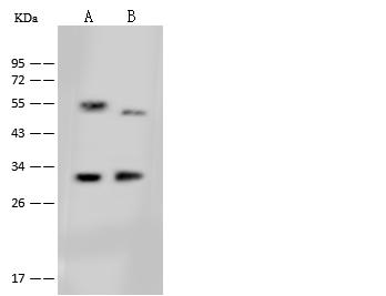 DHRS3 / SDR1 Antibody - Anti-DHRS3 rabbit polyclonal antibody at 1:500 dilution. Lane A: A375 Whole Cell Lysate. Lane B: HepG2 Whole Cell Lysate. Lysates/proteins at 30 ug per lane. Secondary: Goat Anti-Rabbit IgG (H+L)/HRP at 1/10000 dilution. Developed using the ECL technique. Performed under reducing conditions. Predicted band size: 34 kDa.