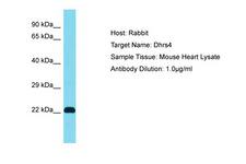 DHRS4 / PSCD Antibody -  This image was taken for the unconjugated form of this product. Other forms have not been tested.