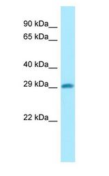DHRS4 / PSCD Antibody - DHRS4 / PSCD antibody Western Blot of COLO205.  This image was taken for the unconjugated form of this product. Other forms have not been tested.