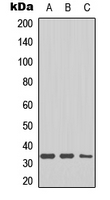 DHRS4 / PSCD Antibody - Western blot analysis of DHRS4 expression in HepG2 (A); mouse heart (B); mouse brain (C) whole cell lysates.
