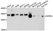 DHRS4 / PSCD Antibody - Western blot analysis of extracts of various cell lines, using DHRS4 antibody at 1:1000 dilution. The secondary antibody used was an HRP Goat Anti-Rabbit IgG (H+L) at 1:10000 dilution. Lysates were loaded 25ug per lane and 3% nonfat dry milk in TBST was used for blocking. An ECL Kit was used for detection and the exposure time was 1s.
