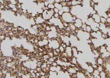 DHRS4 / PSCD Antibody - 1:100 staining mouse lung tissue by IHC-P. The sample was formaldehyde fixed and a heat mediated antigen retrieval step in citrate buffer was performed. The sample was then blocked and incubated with the antibody for 1.5 hours at 22°C. An HRP conjugated goat anti-rabbit antibody was used as the secondary.